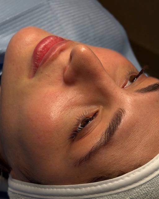 حالات قبل و بعد - 14