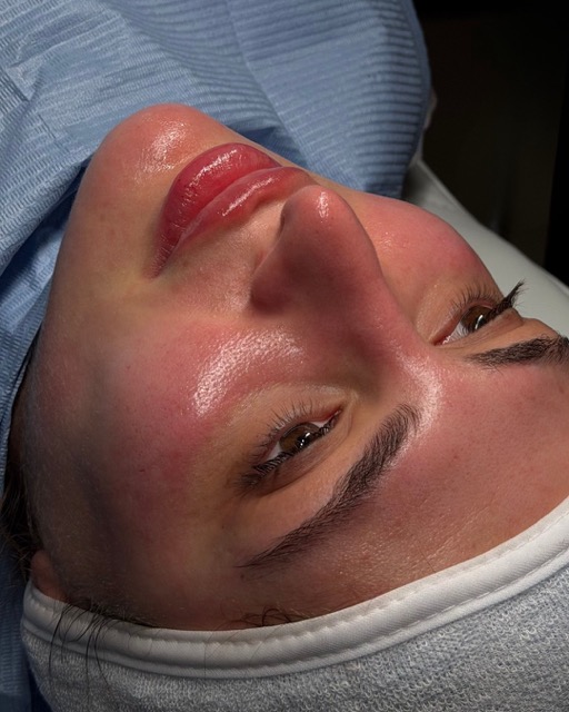 حالات قبل و بعد - 15