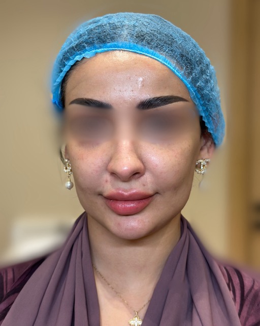 حالات قبل و بعد - 19