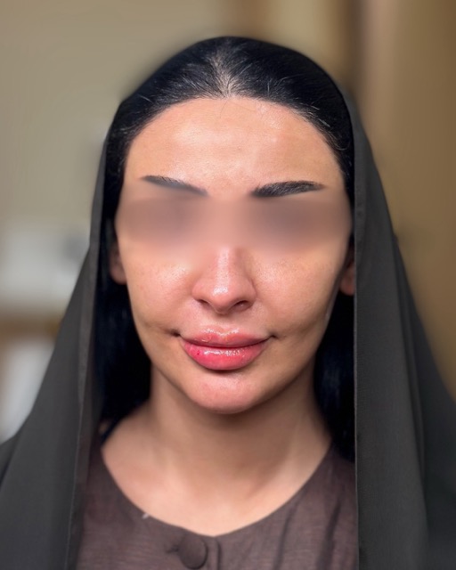 حالات قبل و بعد - 20