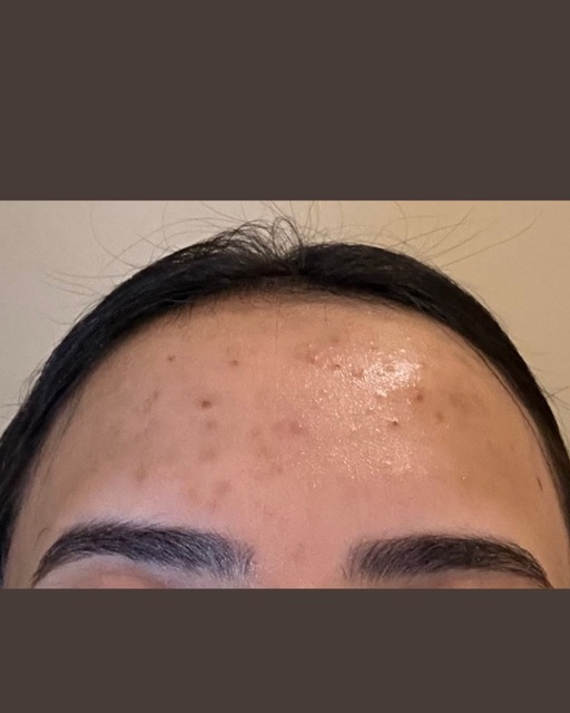 حالات قبل و بعد - 21