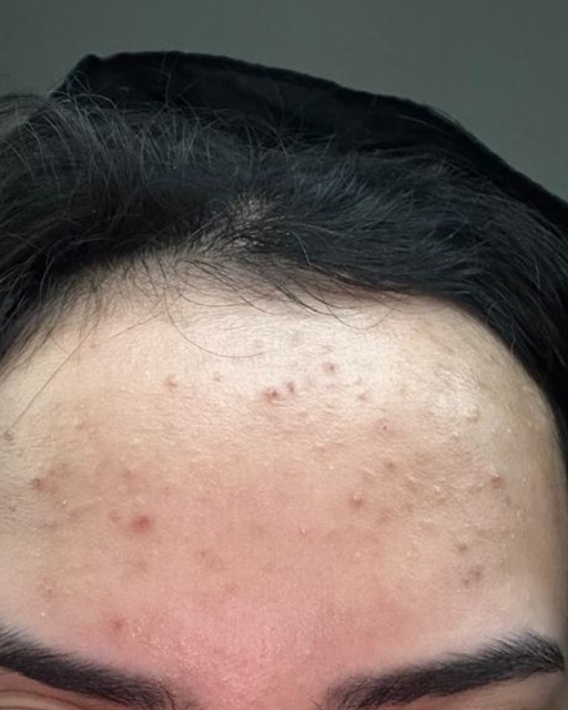 حالات قبل و بعد - 25