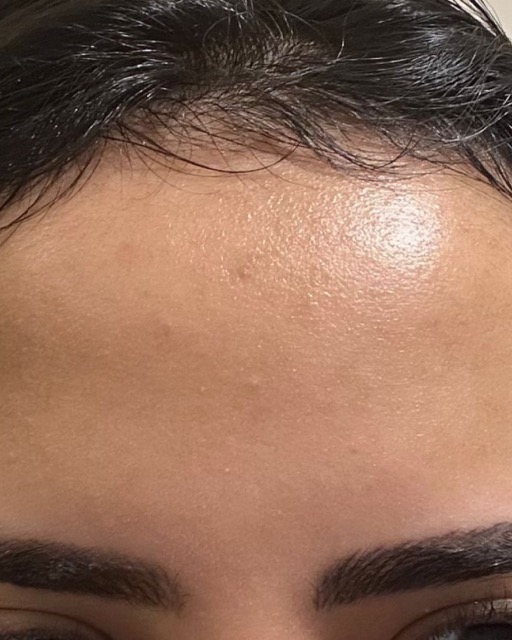 حالات قبل و بعد - 26