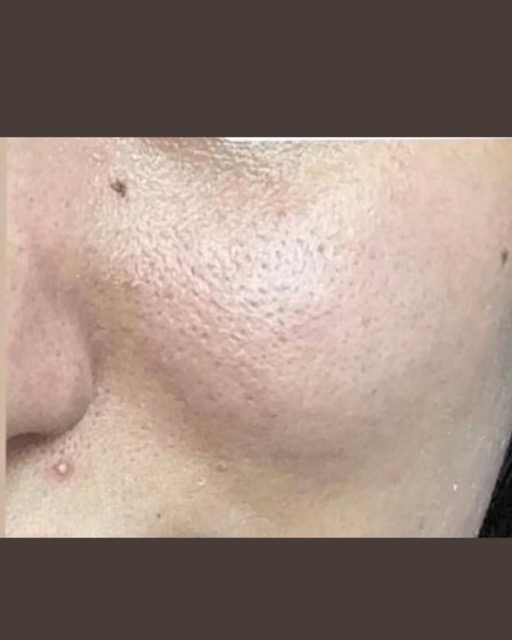 حالات قبل و بعد - 27