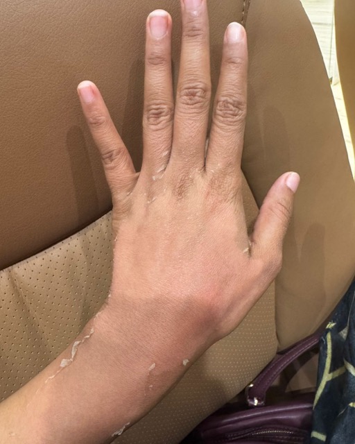 حالات قبل و بعد - 30