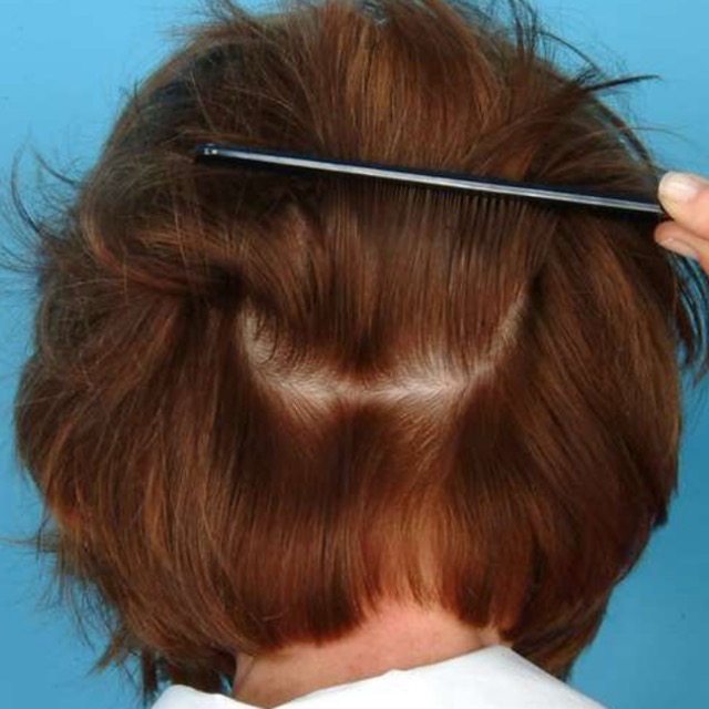 حالات قبل و بعد - 54