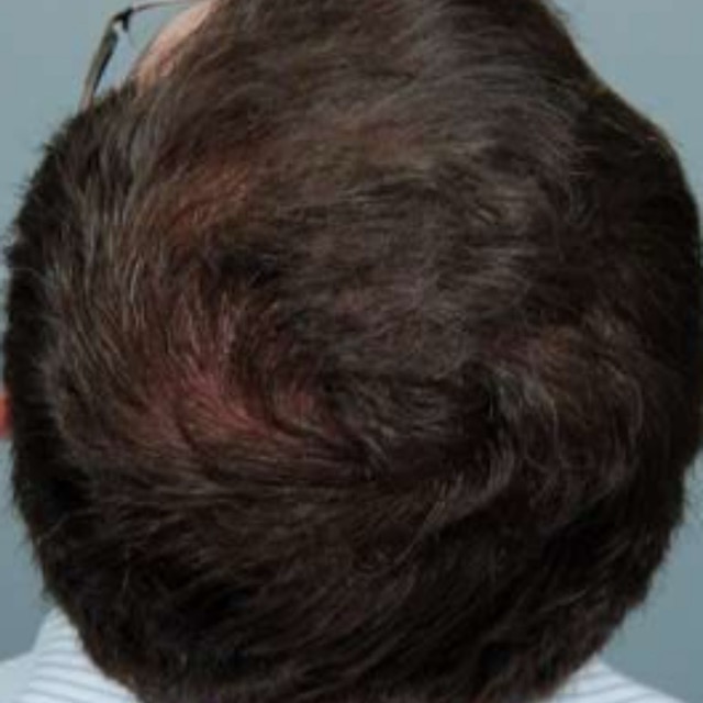 حالات قبل و بعد - 55