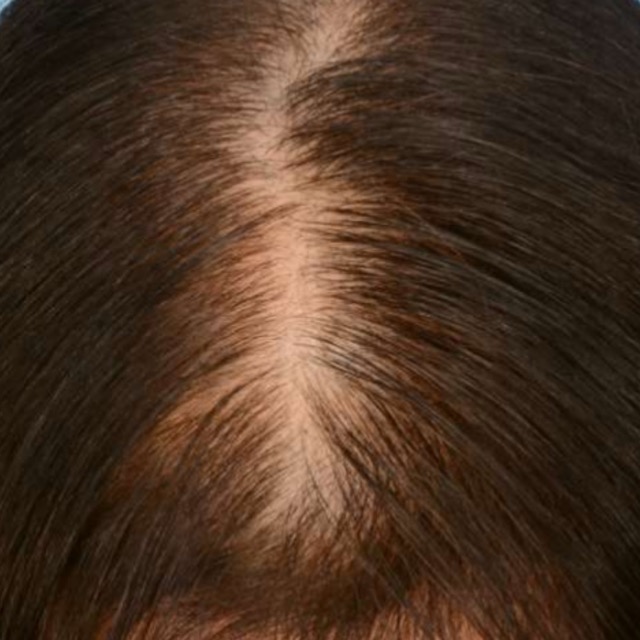 حالات قبل و بعد - 7