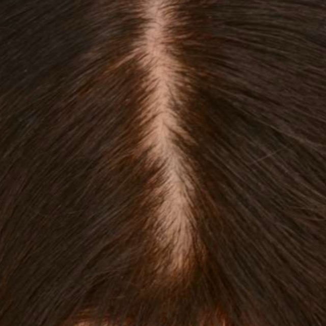 حالات قبل و بعد - 8