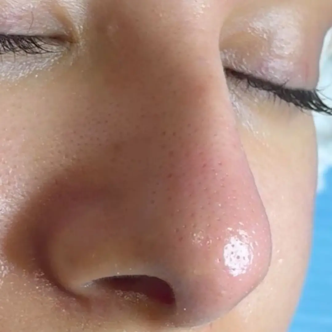 هايدرافيشيل في لوسيرا 1 بعد