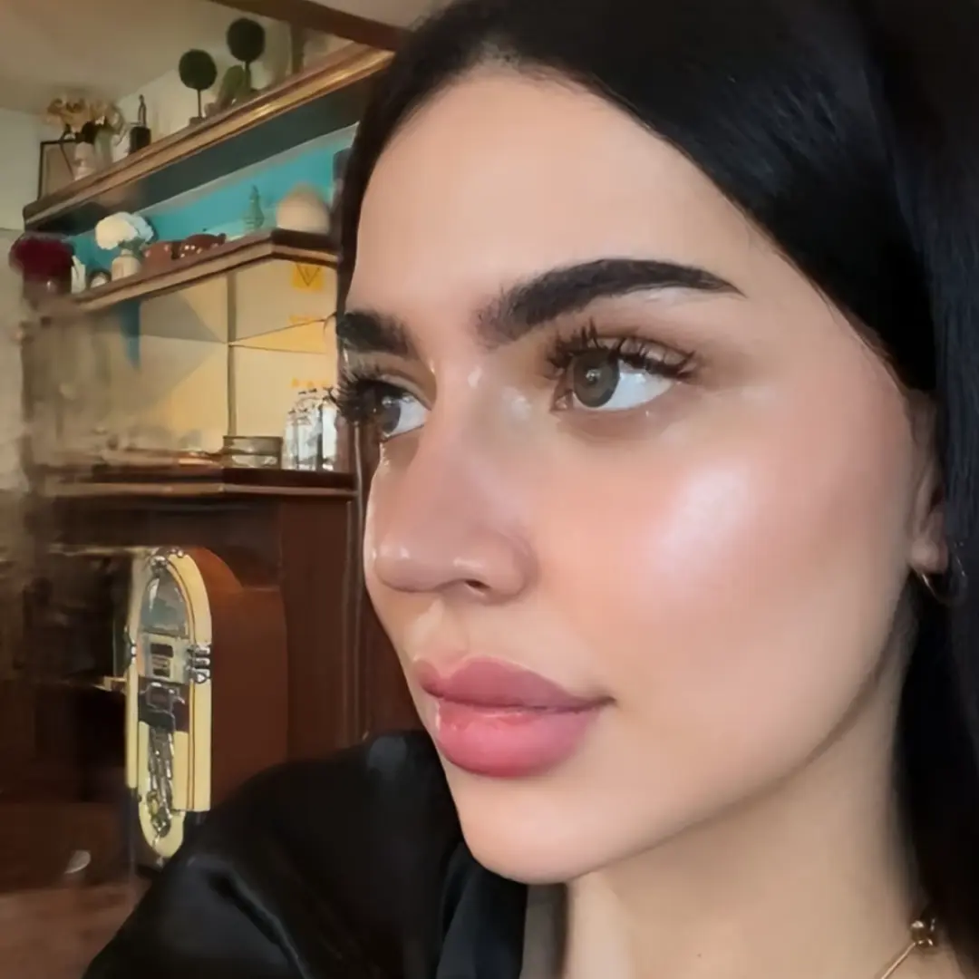 حالة-4-بوتكس-في-لوسيرا-بعد