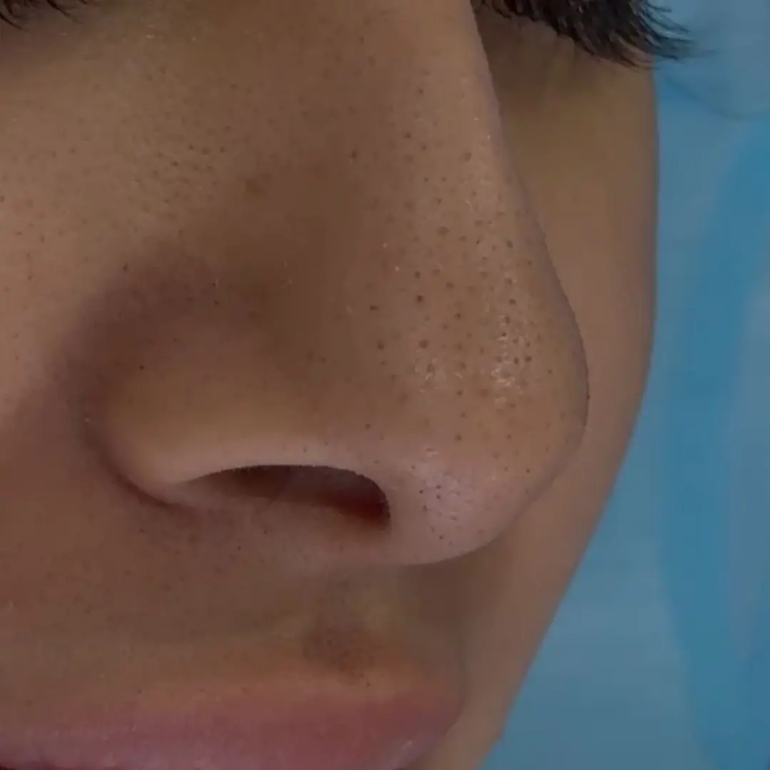 هايدرافيشيل-في-لوسيرا-1-قبل