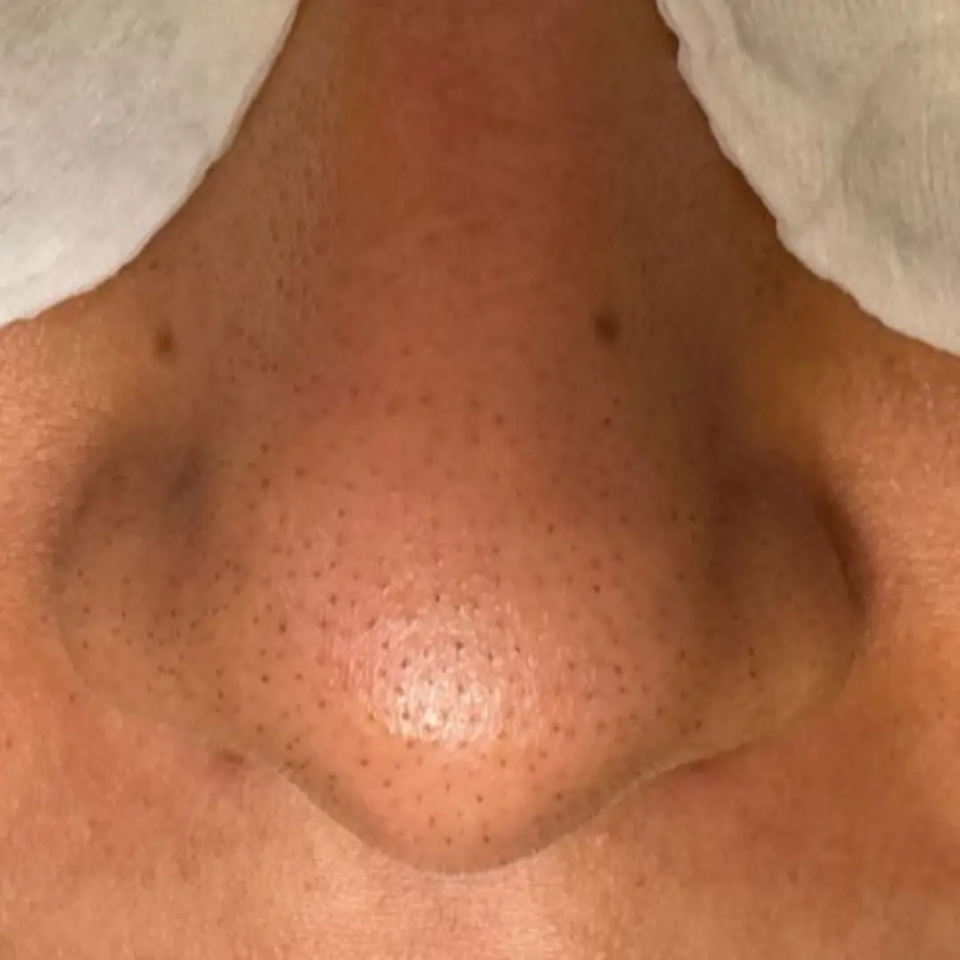 هايدرافيشيل-في-لوسيرا-3-قبل